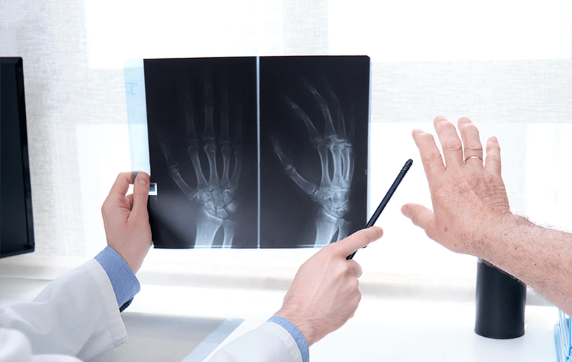 diagnosticul de artroză articulară